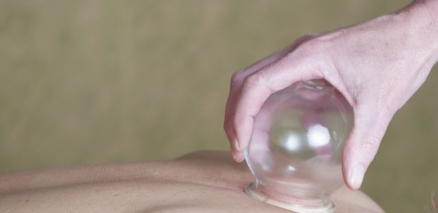 Benefits of Therapeutic Cupping