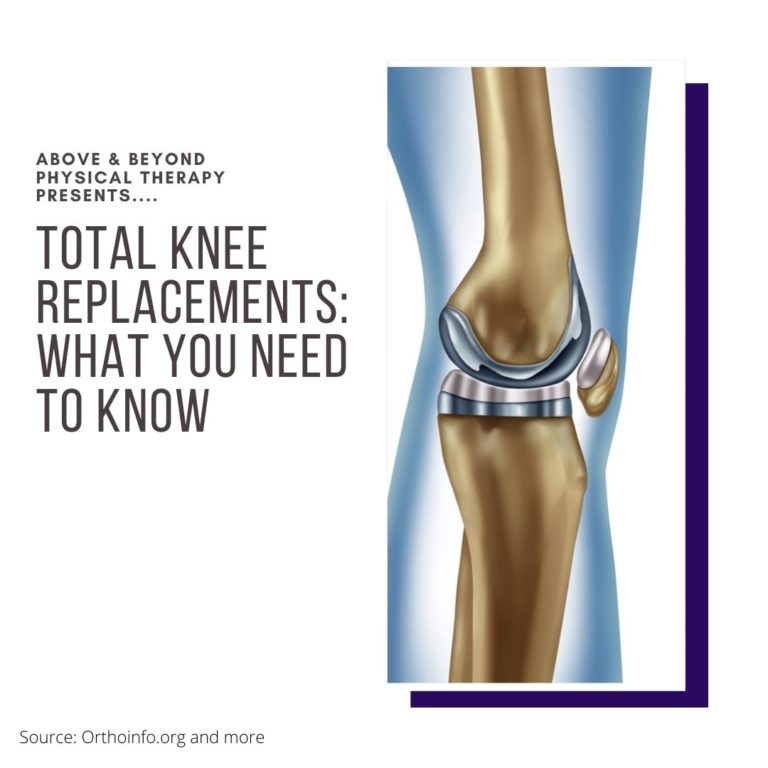 Total Knee Replacement Rehab Fact Sheet Series Above & Beyond